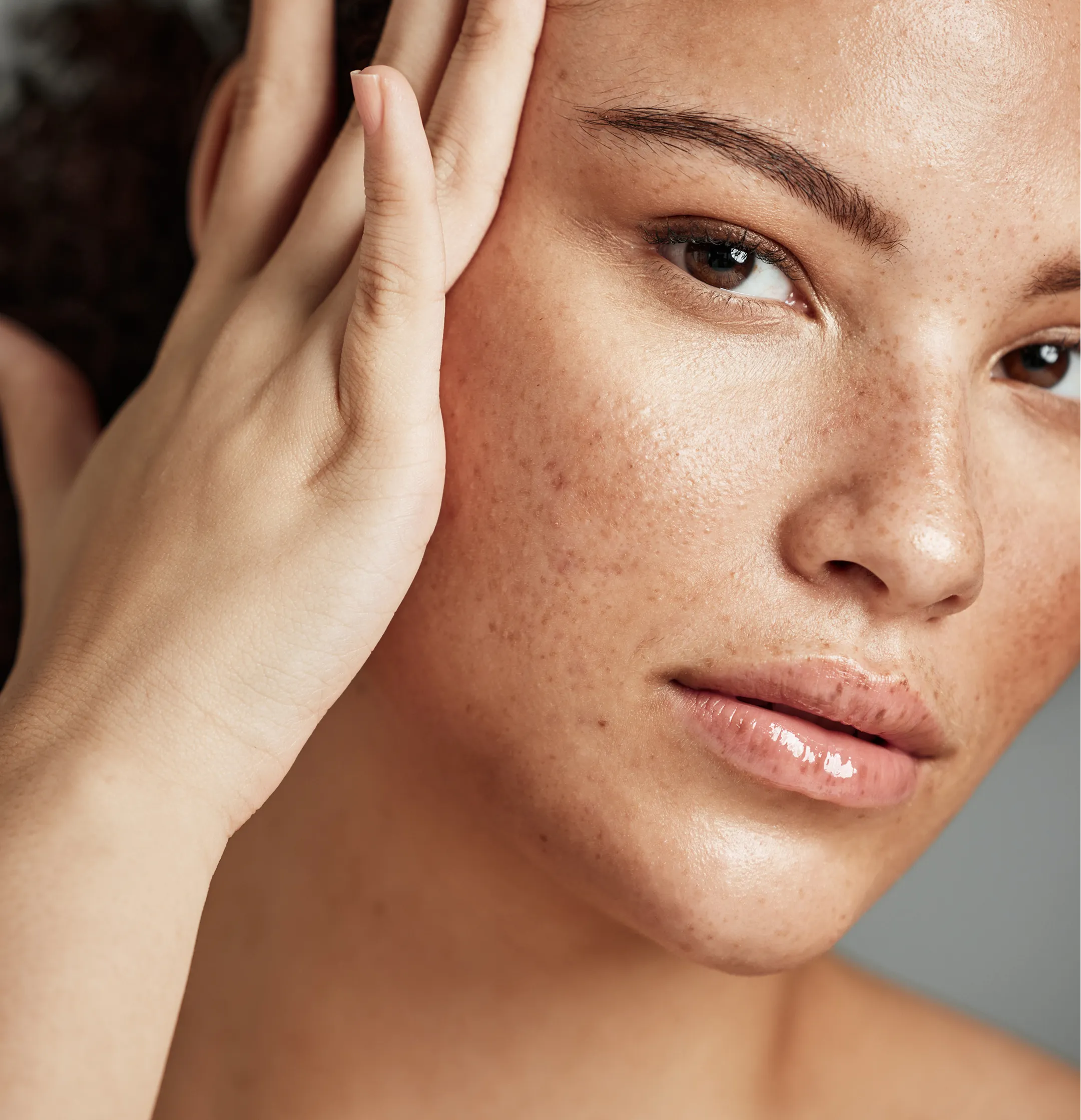 Pigmentation & Melasma