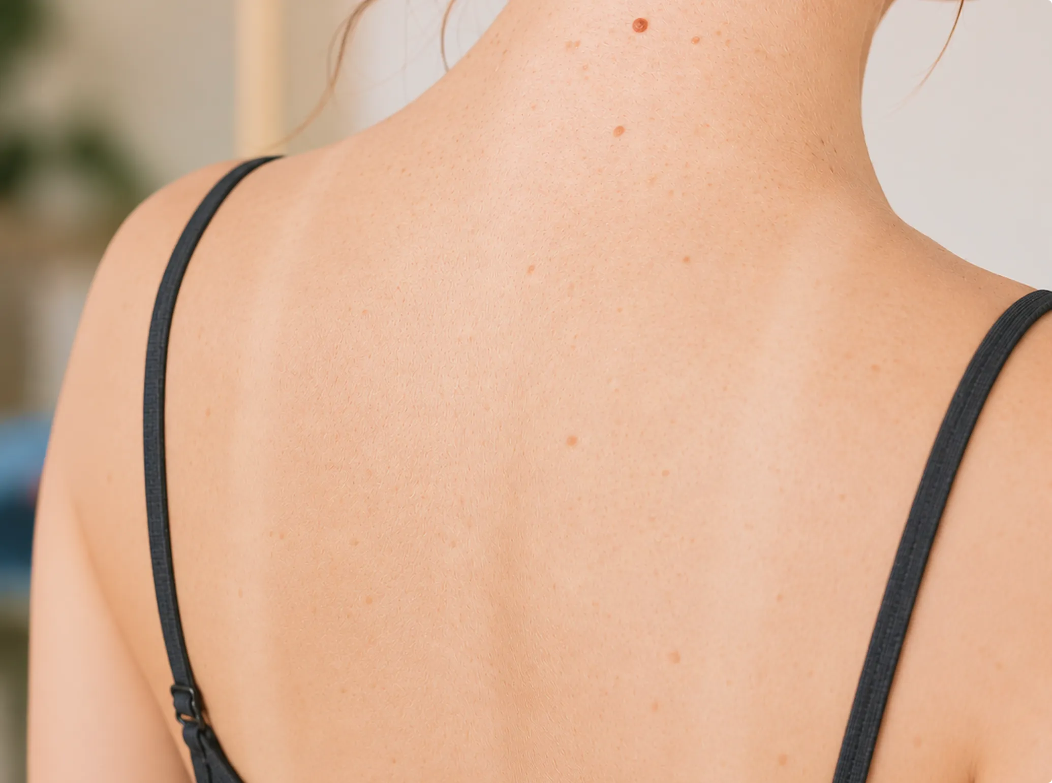 Body Brightening, after