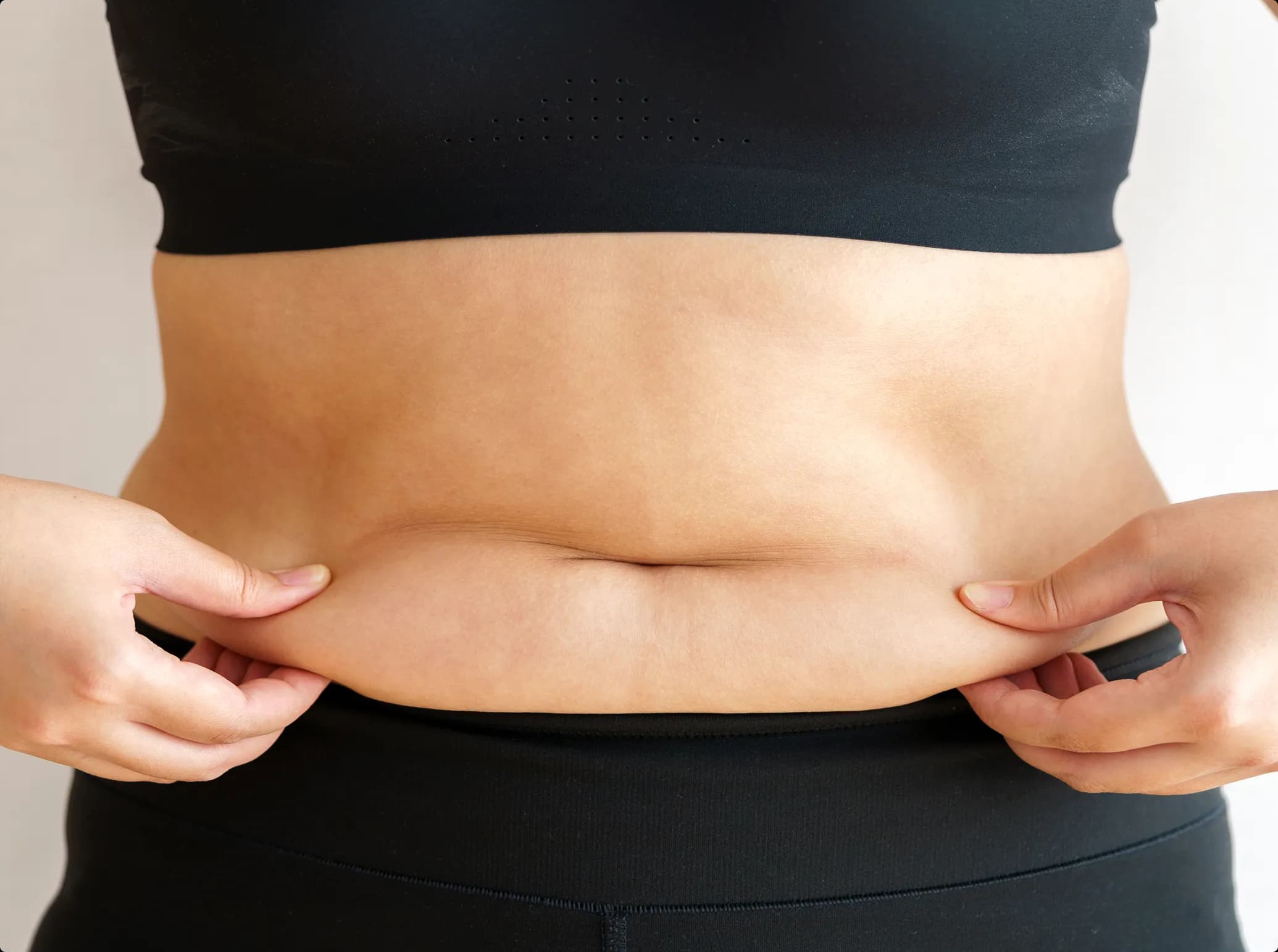 CELLUSLIM (Injection), before