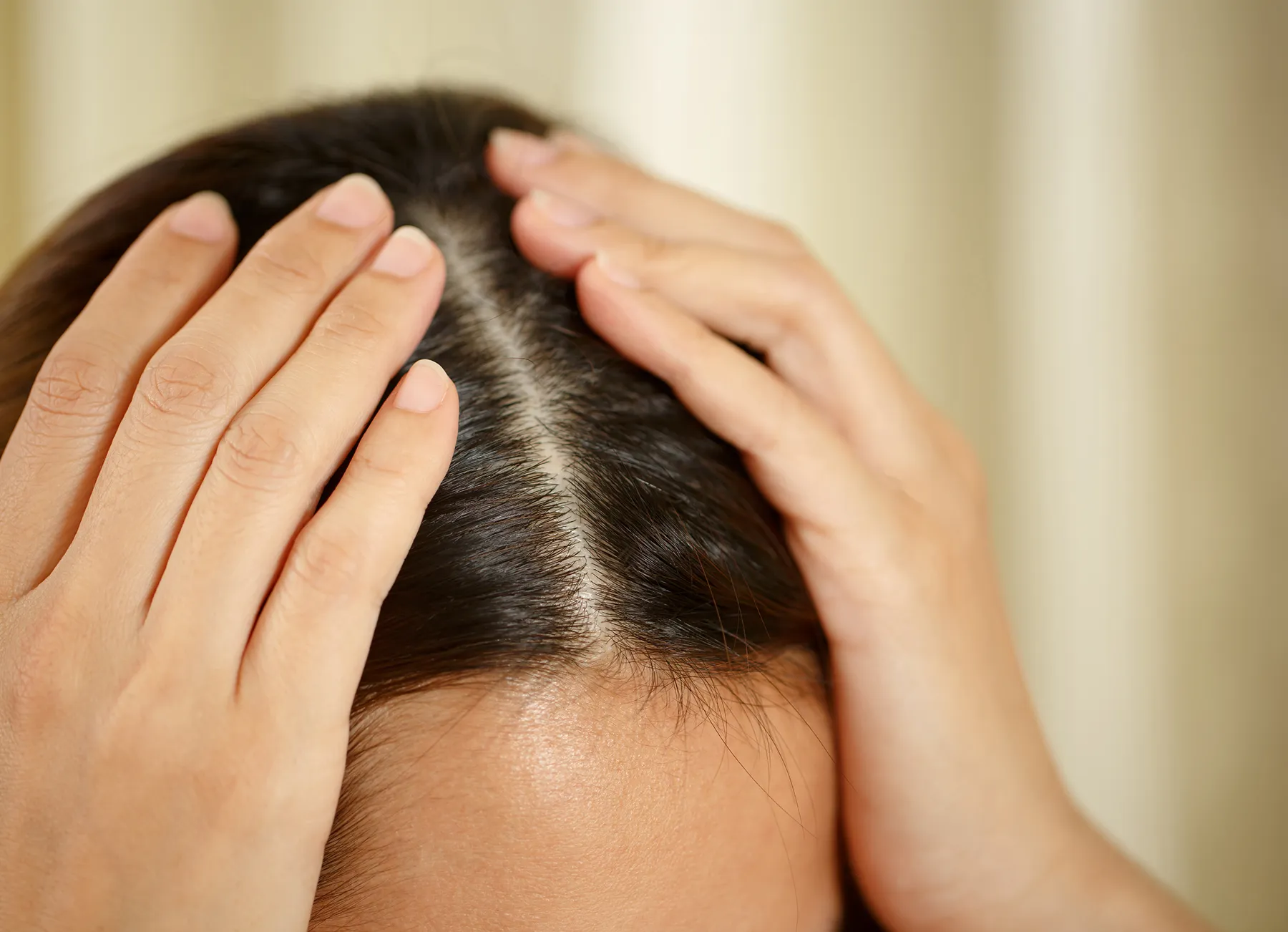 Scalp Concerns