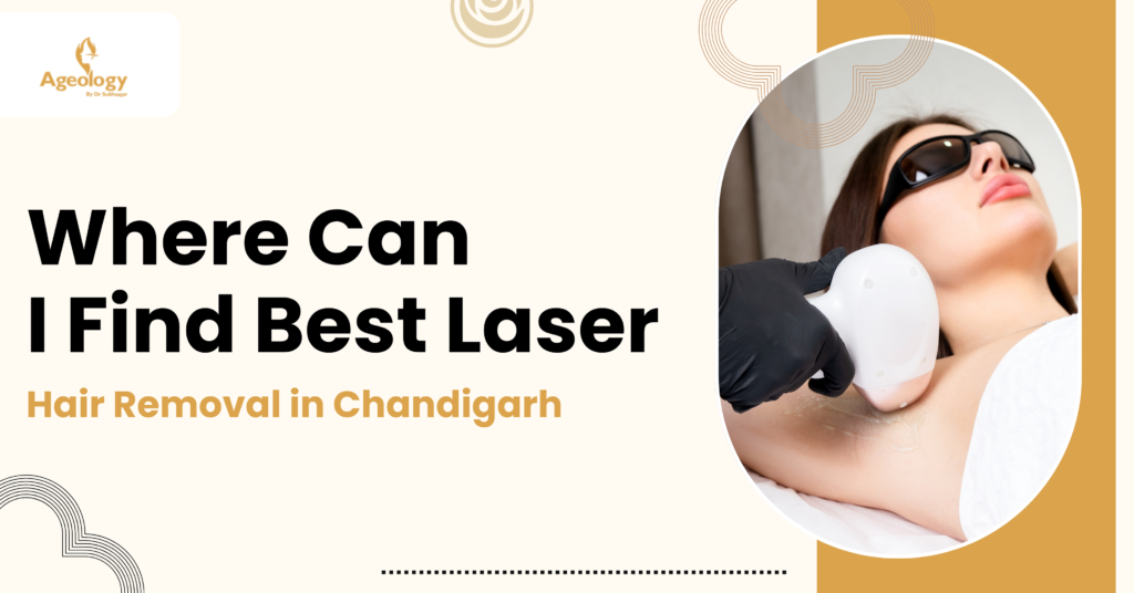 Laser hair removal in Chandigarh